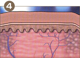 皮膚内に新しいコラーゲンや弾性繊維が張り巡らされ、健康的な肌の状態が保たれます。